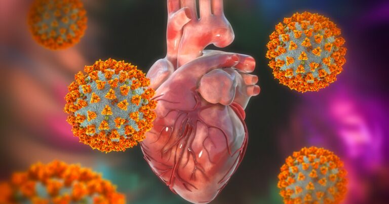 Vlny infekce COVID-19 spojené s nárůstem počtu úmrtí na infarkt